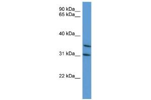 WB Suggested Anti-MAPKAPK3 Antibody Titration: 0. (MAPKAP Kinase 3 anticorps  (C-Term))