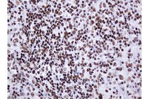 Image no. 5 for anti-Decapping Enzyme, Scavenger (DCPS) antibody (ABIN1497781)