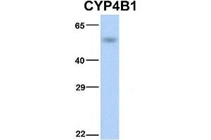 Host:  Rabbit  Target Name:  CYP4B1  Sample Type:  Human Fetal Lung  Antibody Dilution:  1.