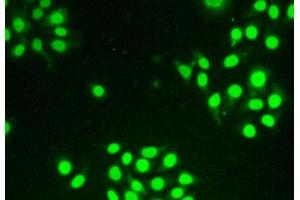 Figure:FITC staining on IHC-P Simple: Hela cells
