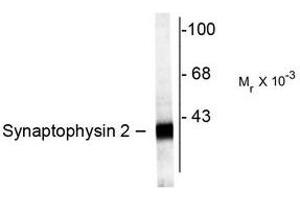 Image no. 1 for anti-Synaptoporin (SYNPR) (C-Term) antibody (ABIN372722) (Synaptoporin anticorps  (C-Term))