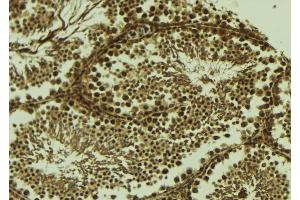 ABIN6273707 at 1/100 staining Mouse testis tissue by IHC-P. (SYCP1 anticorps  (C-Term))