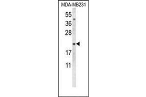 Western blot analysis of Oxytocin Antibody (Center) in MDA-MB231 cell line lysates (35ug/lane).