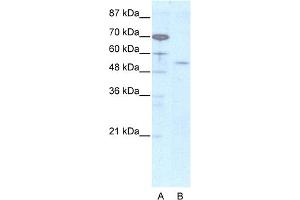 WB Suggested Anti-EVX2 Antibody Titration:  2. (EVX2 anticorps  (N-Term))