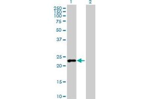Western Blot analysis of C7orf16 expression in transfected 293T cell line by C7orf16 MaxPab polyclonal antibody. (G Substrate anticorps  (AA 1-155))