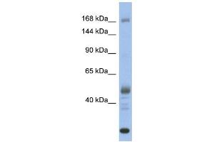 WB Suggested Anti-CHD1 Antibody Titration:  0. (CHD1 anticorps  (Middle Region))