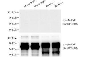 Western blot analysis of phospho-TAU (S202/T205) (ABIN7075838) at dilution of 1: 1000 The figure above was treated with phospho-blocking pepide, the figure below was treated with non-phospho- blocking pepide. (tau anticorps  (pSer202, pThr205))