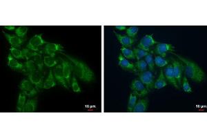 ICC/IF Image TSFM antibody detects TSFM protein at mitochondria by immunofluorescent analysis. (TSFM anticorps)