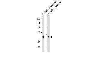 All lanes : Anti-WNT10B Antibody (Center) at 1:2000 dilution Lane 1: Rat skeletal muscle whole lysate Lane 2: Human skeletal muscle whole lysate Lysates/proteins at 20 μg per lane.