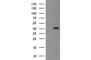 Image no. 2 for anti-Mitogen-Activated Protein Kinase 13 (MAPK13) antibody (ABIN1499953)