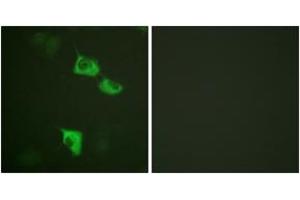 Immunofluorescence analysis of HuvEc cells, using eEF2 (Ab-56) Antibody.