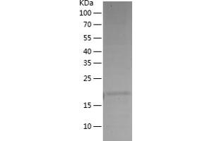 Western Blotting (WB) image for Caspase 9, Apoptosis-Related Cysteine Peptidase (CASP9) (AA 1-159) protein (His tag) (ABIN7122171)
