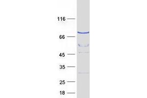 Validation with Western Blot