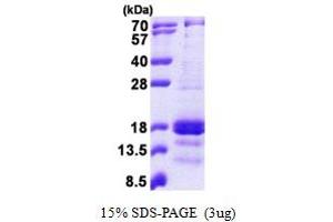 SDS-PAGE (SDS) image for gamma-Interferon-Induced Monokine (CXCL9) (AA 23-125) protein (His tag) (ABIN5853039)