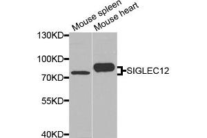 Western blot analysis of extracts of various cell lines, using SIGLEC12 antibody. (SIGLEC12 anticorps)