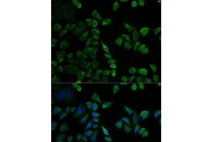 Immunofluorescence analysis of U2OS cells using MSLN Polyclonal Antibody (Mesothelin anticorps)