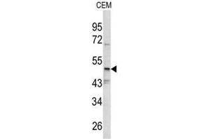 Western blot analysis of SMYD3 antibody (N-term) in CEM cell line lysates (35ug/lane). (SMYD3 anticorps  (N-Term))