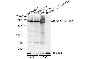 Western blot analysis of extracts of various cell lines, using Phospho-SMC1A-S957 antibody. (SMC1A anticorps  (pSer957))