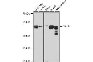 Western blot analysis of extracts of various cell lines, using GSK3α antibody (ABIN1680131, ABIN3015275, ABIN3015276 and ABIN6213918) at 1:1000 dilution.