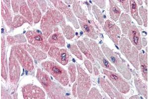 Human Heart (formalin-fixed, paraffin-embedded) stained with PARD6A antibody ABIN337017 at 5 ug/ml followed by biotinylated anti-goat IgG secondary antibody ABIN481715, alkaline phosphatase-streptavidin and chromogen. (PARD6A anticorps  (AA 334-346))