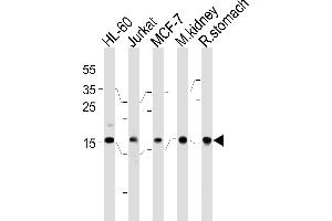 NME2 Antibody (F40) (ABIN392656 and ABIN2842157) western blot analysis in HL-60,Jurkat,MCF-7 cell line,mouse kidney and rat stomach tissue lysates (35 μg/lane). (NME2 anticorps  (N-Term))