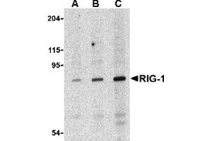 Western Blotting (WB) image for anti-DEAD (Asp-Glu-Ala-Asp) Box Polypeptide 58 (DDX58) antibody (ABIN1031791) (DDX58 anticorps)