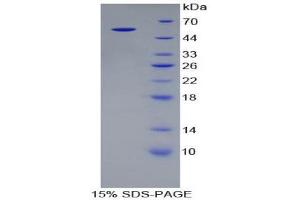 SDS-PAGE (SDS) image for Alanine Aminotransferase (ALT) (AA 1-496) protein (His tag) (ABIN1078750)