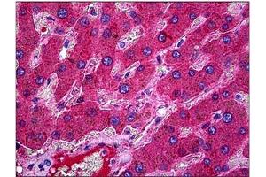 Human Liver: Formalin-Fixed, Paraffin-Embedded (FFPE). (C3 anticorps)