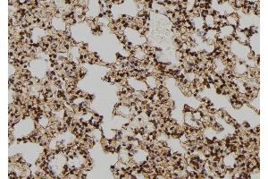 ABIN6277586 at 1/100 staining Rat lung tissue by IHC-P. (TPT1 anticorps  (Internal Region))