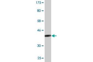 Western Blot detection against Immunogen (37.