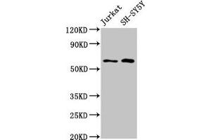 Western Blot Positive WB detected in: Jurkat whole cell lysate, SH-SY5Y whole cell lysate All lanes: BORA antibody at 4.