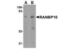 Western blot analysis of RANBP10 (arrow) in human skeletal muscle tissue lysate with RANBP10 Antibody at (A) 1 and (B) 2 μg/ml. (RANBP10 anticorps  (Center))