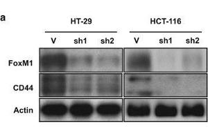 Knockdown of FoxM1 expression in HT-29 and HCT-116 cells reduces their CD44+ subpopulations and their sensitivity to thiostrepton.