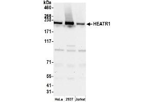 anti-HEAT Repeat Containing 1 (HEATR1) (AA 2094-2144) antibody