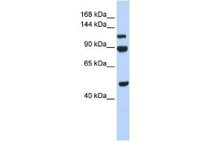 WB Suggested Anti-NARG1L Antibody Titration:  0. (NARG1L anticorps  (Middle Region))