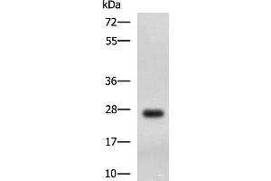 Western blot analysis of MCF7 cell lysate using DHRS2 Polyclonal Antibody at dilution of 1:750 (DHRS2 anticorps)
