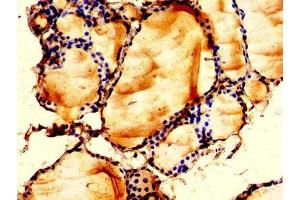 IHC image of ABIN7158752 diluted at 1:200 and staining in paraffin-embedded human thyroid tissue performed on a Leica BondTM system.