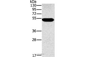 Western blot analysis of Human placenta tissue, using FUCA1 Polyclonal Antibody at dilution of 1:500 (FUCA1 anticorps)