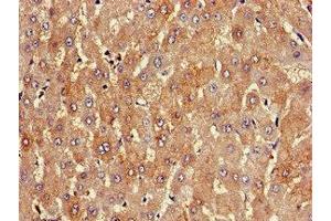 Immunohistochemistry of paraffin-embedded human liver tissue using ABIN7163820 at dilution of 1:100 (PKD1L1 anticorps  (AA 921-1164))