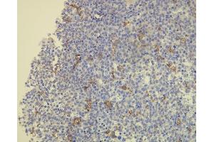 Immunohistochemistry (IHC) image for anti-CD163 (CD163) (AA 134-148), (N-Term) antibody (ABIN870404)