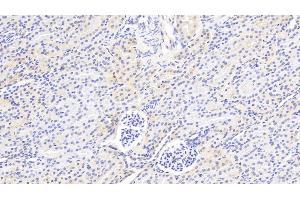 Detection of F2 in Rat Kidney Tissue using Polyclonal Antibody to Coagulation Factor II (F2) (Prothrombin anticorps  (AA 201-323))