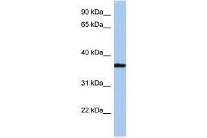 WB Suggested Anti-LDLRAP1 Antibody Titration: 0.