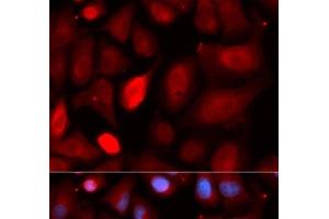 Immunofluorescence analysis of U2OS cells using PDLIM5 Polyclonal Antibody (PDLIM5 anticorps)