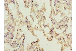 Immunohistochemistry of paraffin-embedded human lung tissue using ABIN7161614 at dilution of 1:100 (NINJ2 anticorps  (AA 17-81))