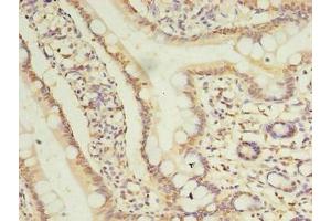 Immunohistochemistry of paraffin-embedded human small intestine tissue using ABIN7173421 at dilution of 1:100 (TRIM15 anticorps  (AA 122-387))