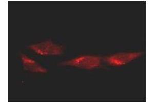 Immunofluorescence microscopy of HeLa cells using anti-p53.