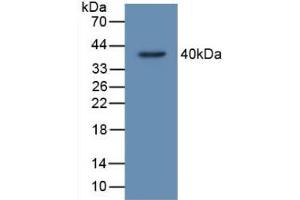 Detection of Recombinant TP53TG5, Human using Polyclonal Antibody to TP53 Target Gene 5 (TP53TG5)