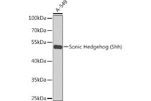 Western blot analysis of extracts of A-549 cells, using Sonic Hedgehog (Sonic Hedgehog (Shh)) antibody  at 1:1000 dilution. (Sonic Hedgehog anticorps)