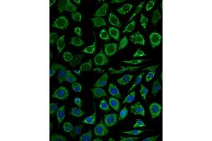 Immunofluorescence analysis of L929 cells using Bcl-2 antibody (ABIN7265812) at dilution of 1:100. (Bcl-2 anticorps  (AA 1-100))