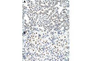 Immunohistochemical staining (Formalin-fixed paraffin-embedded sections) of human lung (A) and human liver (B) with HNRNPA3 polyclonal antibody  at 4-8 ug/mL working concentration. (HNRNPA3 anticorps  (N-Term))